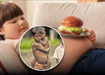 UNICEF confirms a historic first — child obesity surpasses underweight worldwide