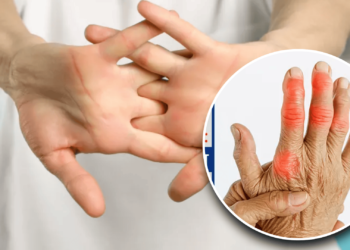 Experts debunk knuckle-cracking myth — studies show no arthritis risk but possible hand strain