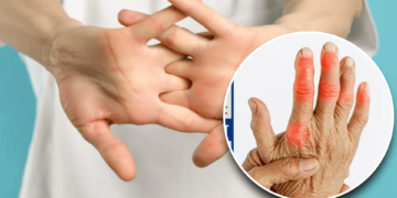 Experts debunk knuckle-cracking myth — studies show no arthritis risk but possible hand strain