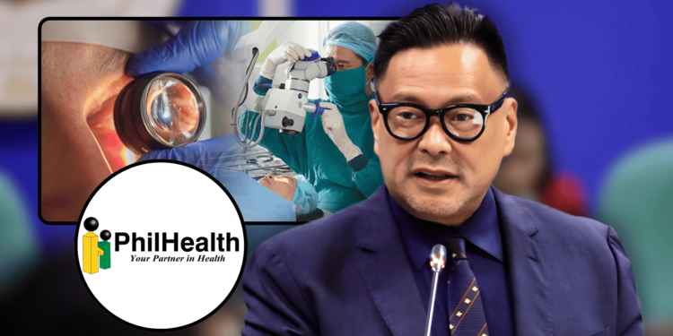 JV Ejercito’s Universal Healthcare law enables 100% PhilHealth coverage for cataract surgery