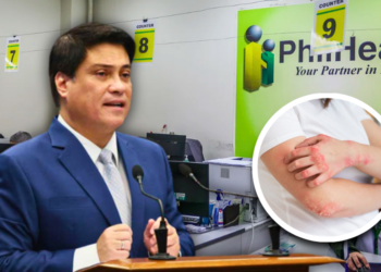 Zubiri calls for PhilHealth to shoulder lupus screening costs after Senate approval