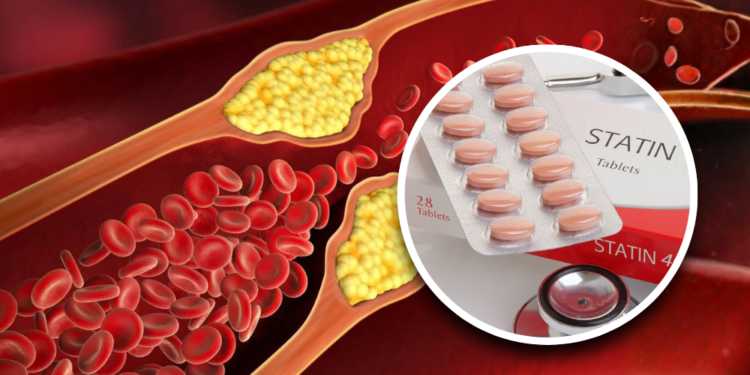 Major trial reveals experimental pill cuts deadly heart risk cholesterol by up to 60%