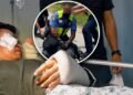 Doctors successfully reattach hero cop’s severed hand after he stops rampaging man armed with large knife