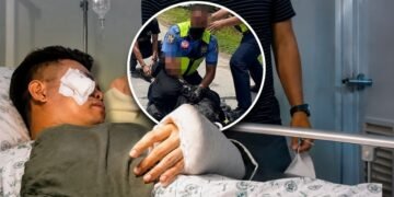 Doctors successfully reattach hero cop’s severed hand after he stops rampaging man armed with large knife