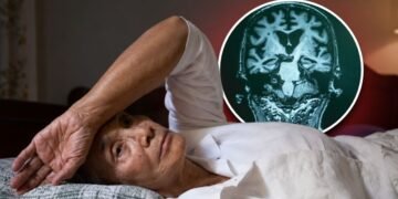 Getting Only 6 Hours of Sleep? Study Links It to 30% Higher Dementia Risk